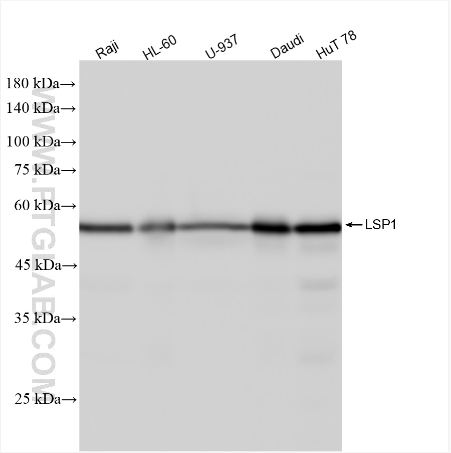 WB analysis using 87378-1-RR