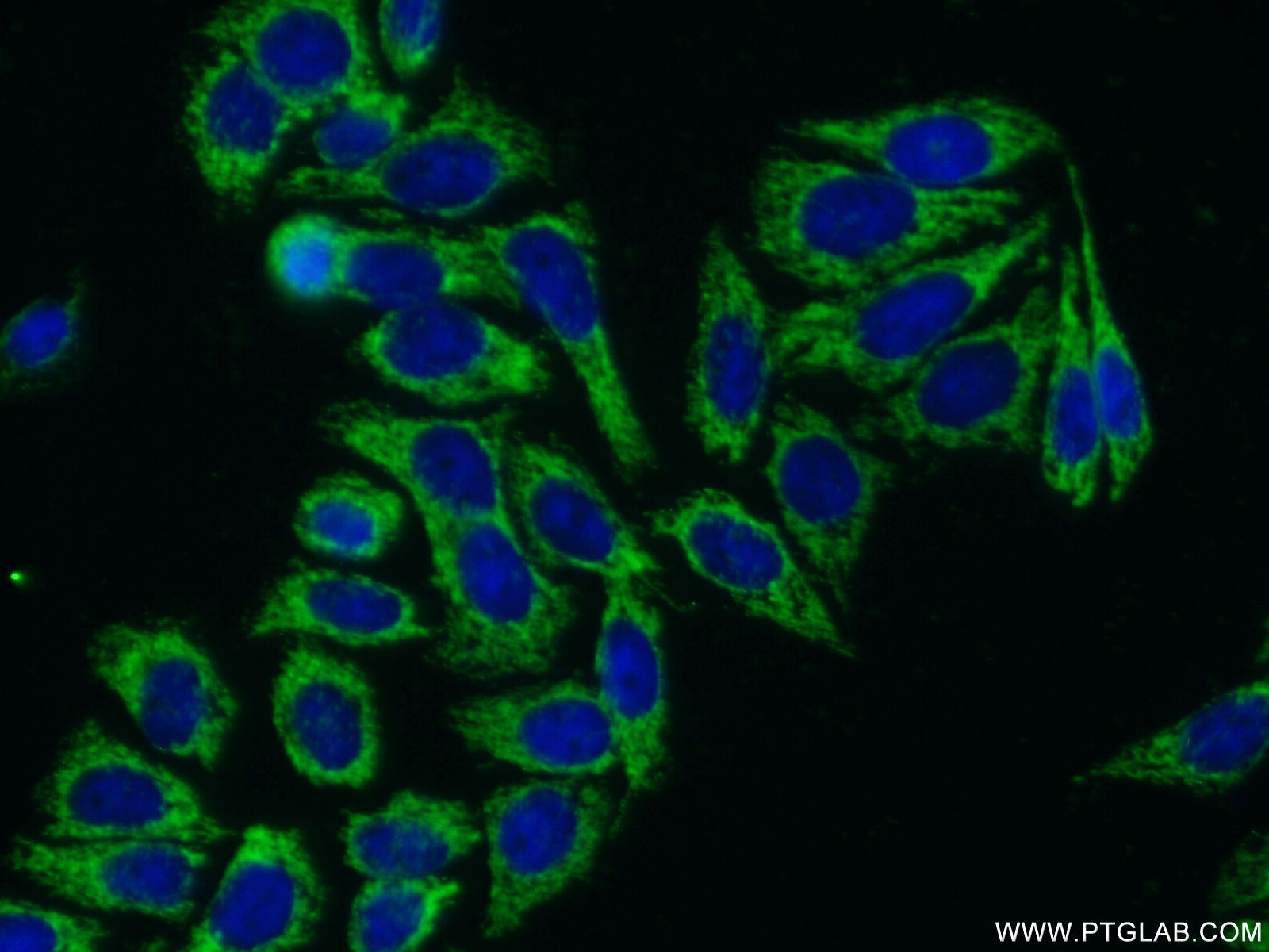 IF Staining of HepG2 using 18693-1-AP