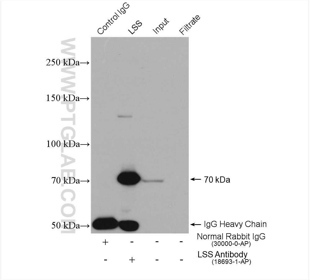 IP experiment of HeLa using 18693-1-AP