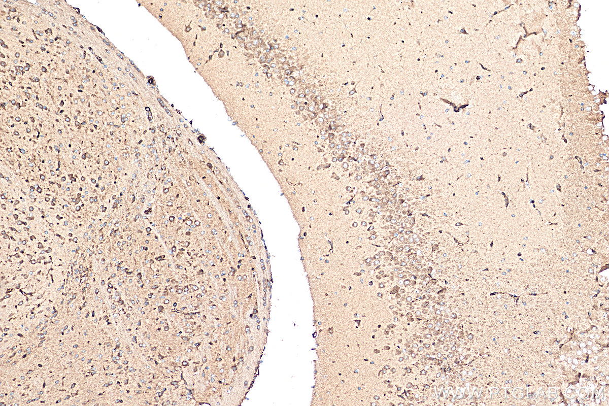 IHC staining of mouse brain using 21361-1-AP (same clone as 21361-1-PBS)