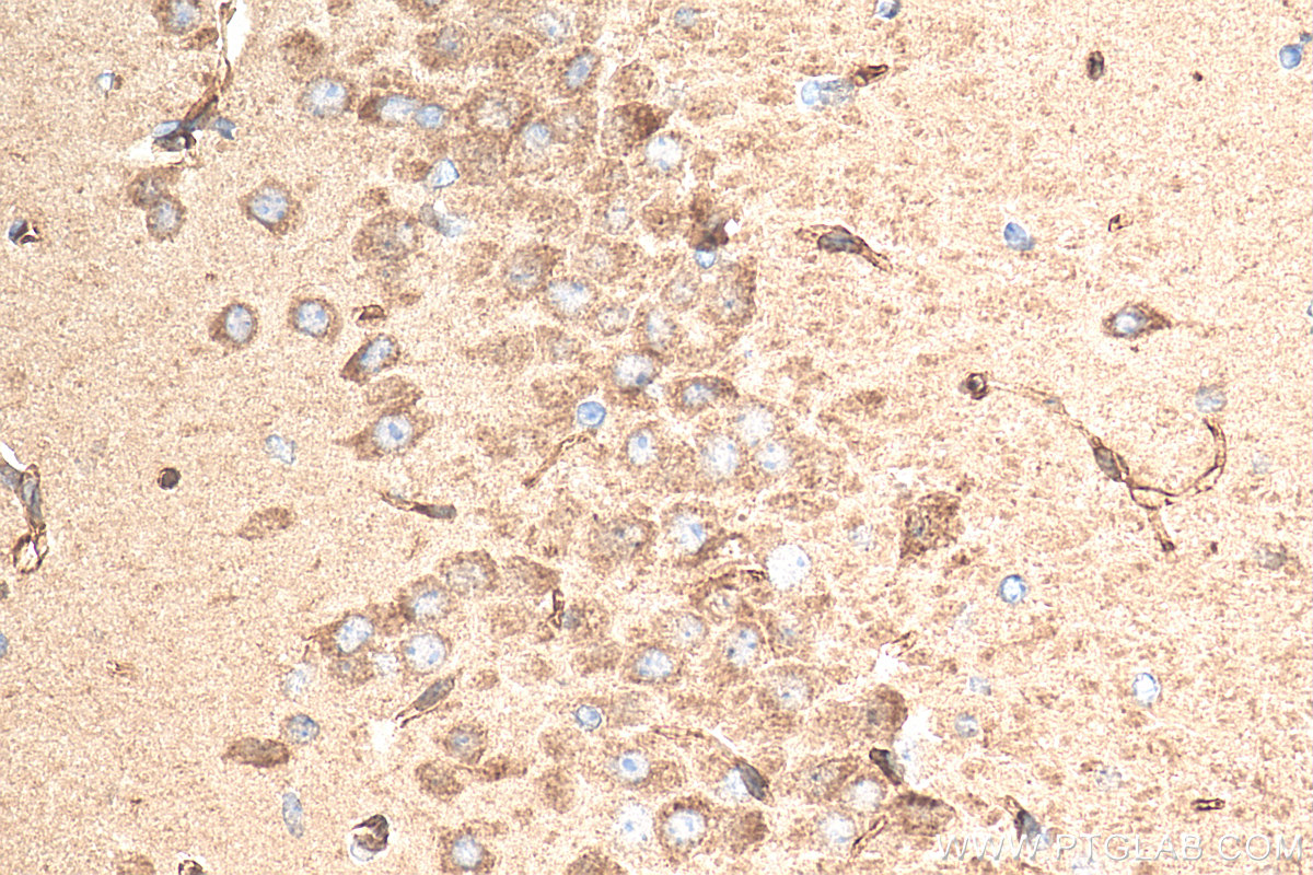 IHC staining of mouse brain using 21361-1-AP