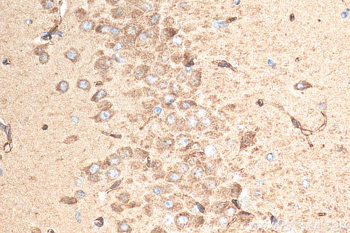 IHC staining of mouse brain using 21361-1-AP (same clone as 21361-1-PBS)