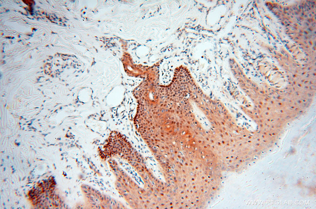 IHC staining of human skin using 13662-1-AP