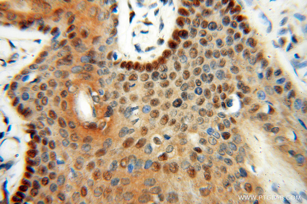 IHC staining of human skin using 13662-1-AP