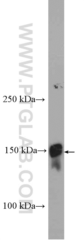 WB analysis of human plasma using 26855-1-AP