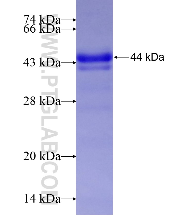 LTBP1 fusion protein Ag17471 SDS-PAGE LTBP1 fusion protein Ag17471 SDS-PAGE