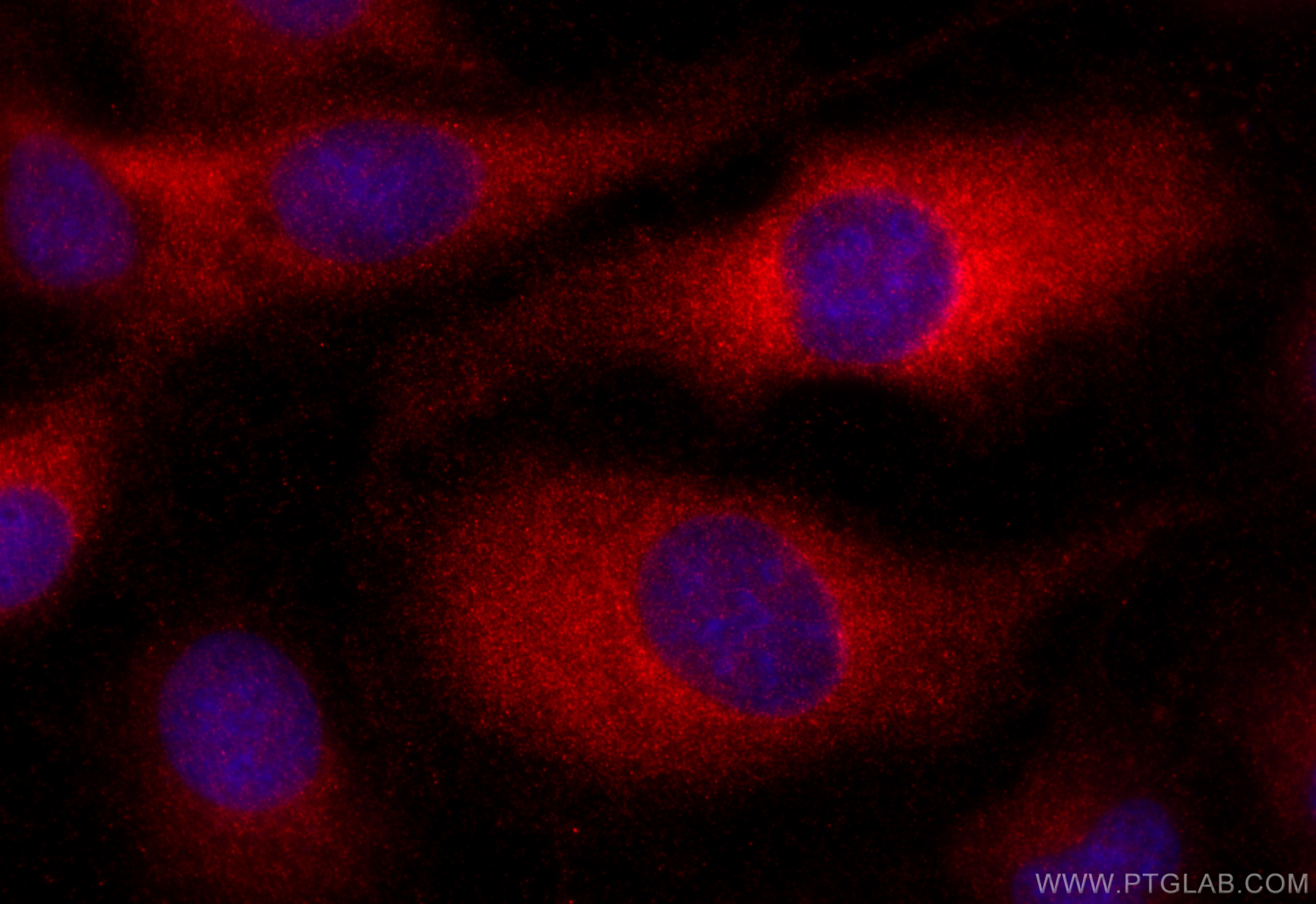 IF Staining of U2OS using 28824-1-AP