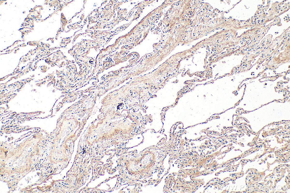 IHC staining of human lung using 28824-1-AP