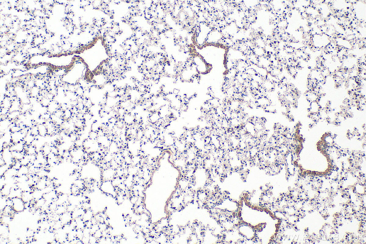 IHC staining of mouse lung using 28824-1-AP