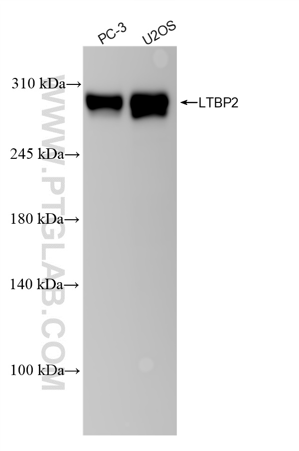 WB analysis using 84574-4-RR (same clone as 84574-4-PBS)
