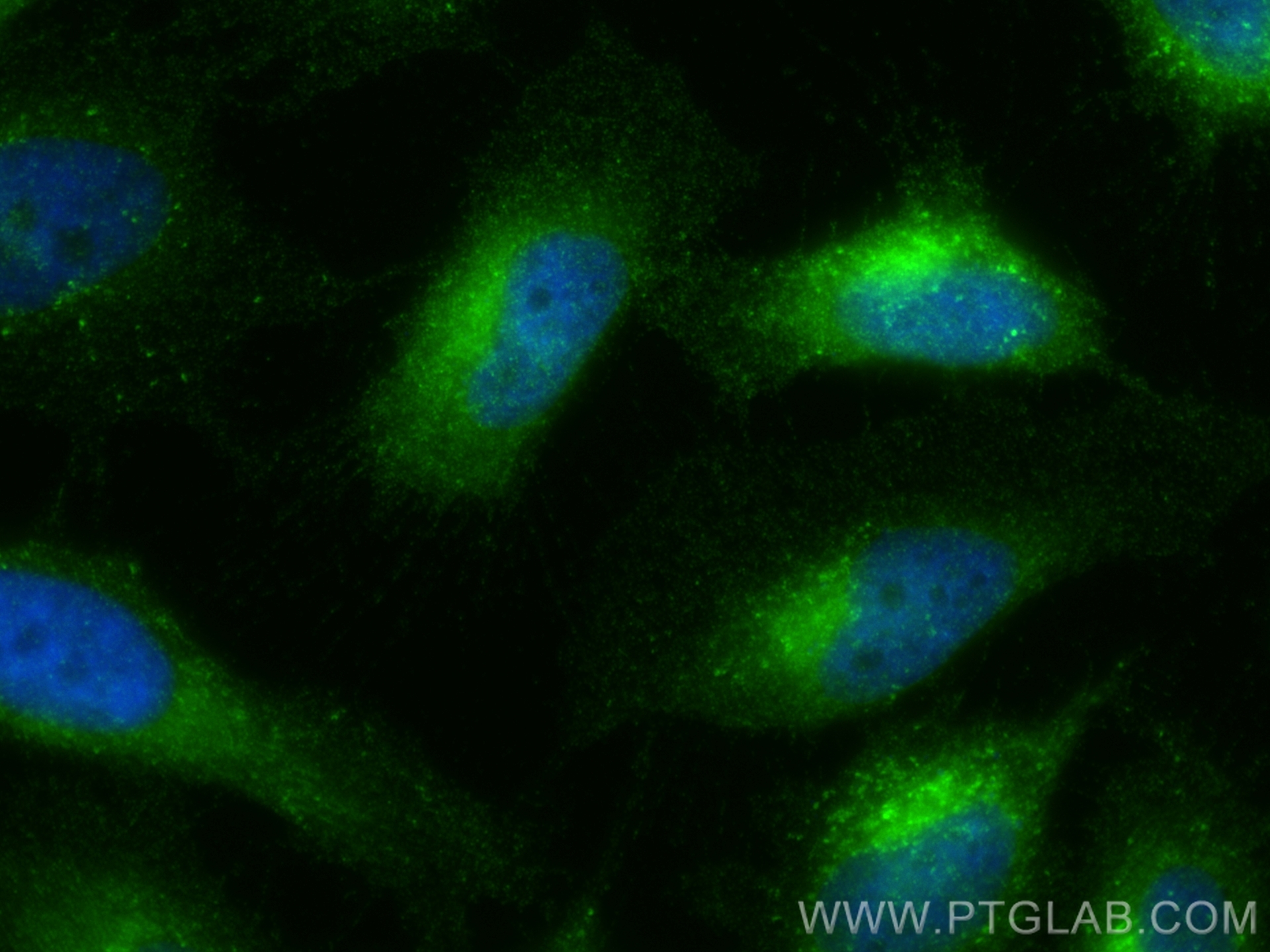 IF Staining of HeLa using 20331-1-AP