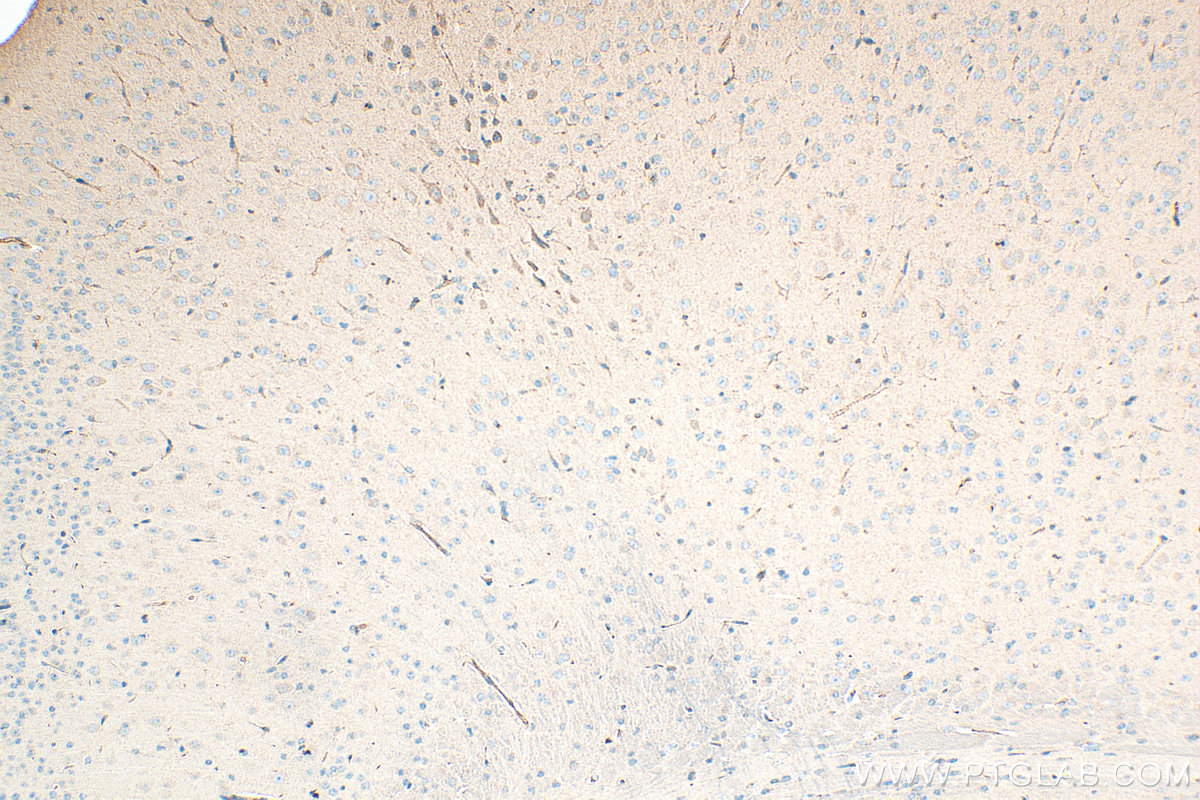 Immunohistochemical analysis of paraffin-embedded mouse brain tissue slide using 10933-1-AP (Lactotransferrin/LTF antibody) at dilution of 1:500 (under 10x lens). Heat mediated antigen retrieval with Tris-EDTA buffer (pH 9.0). IHC staining of mouse brain using 10933-1-AP