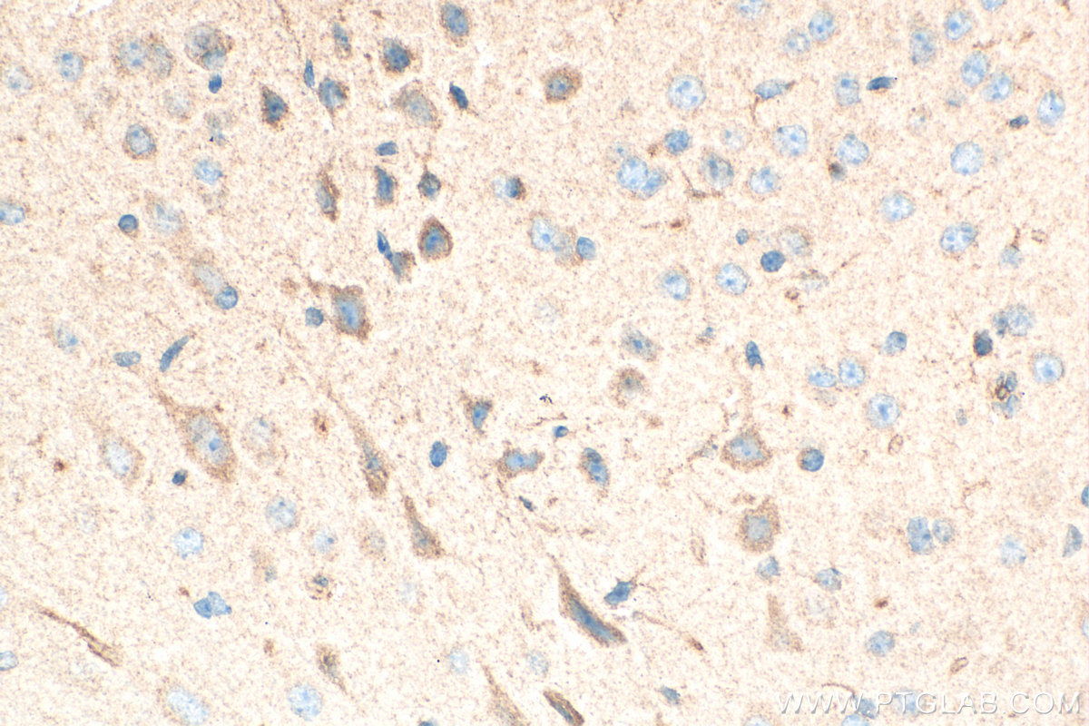 Immunohistochemical analysis of paraffin-embedded mouse brain tissue slide using 10933-1-AP (Lactotransferrin/LTF antibody) at dilution of 1:500 (under 40x lens). Heat mediated antigen retrieval with Tris-EDTA buffer (pH 9.0). IHC staining of mouse brain using 10933-1-AP