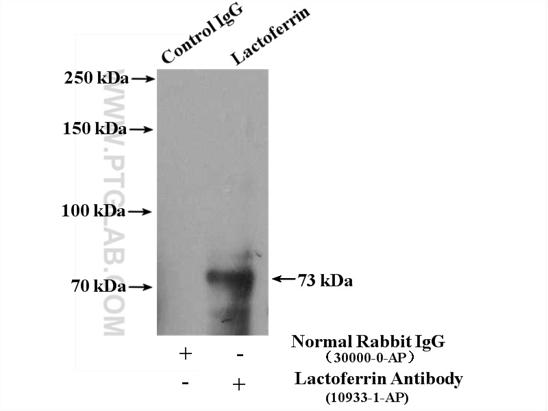 IP experiment of HeLa using 10933-1-AP