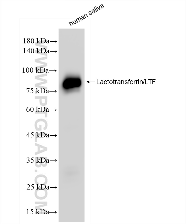 WB analysis of human saliva using 83409-5-RR