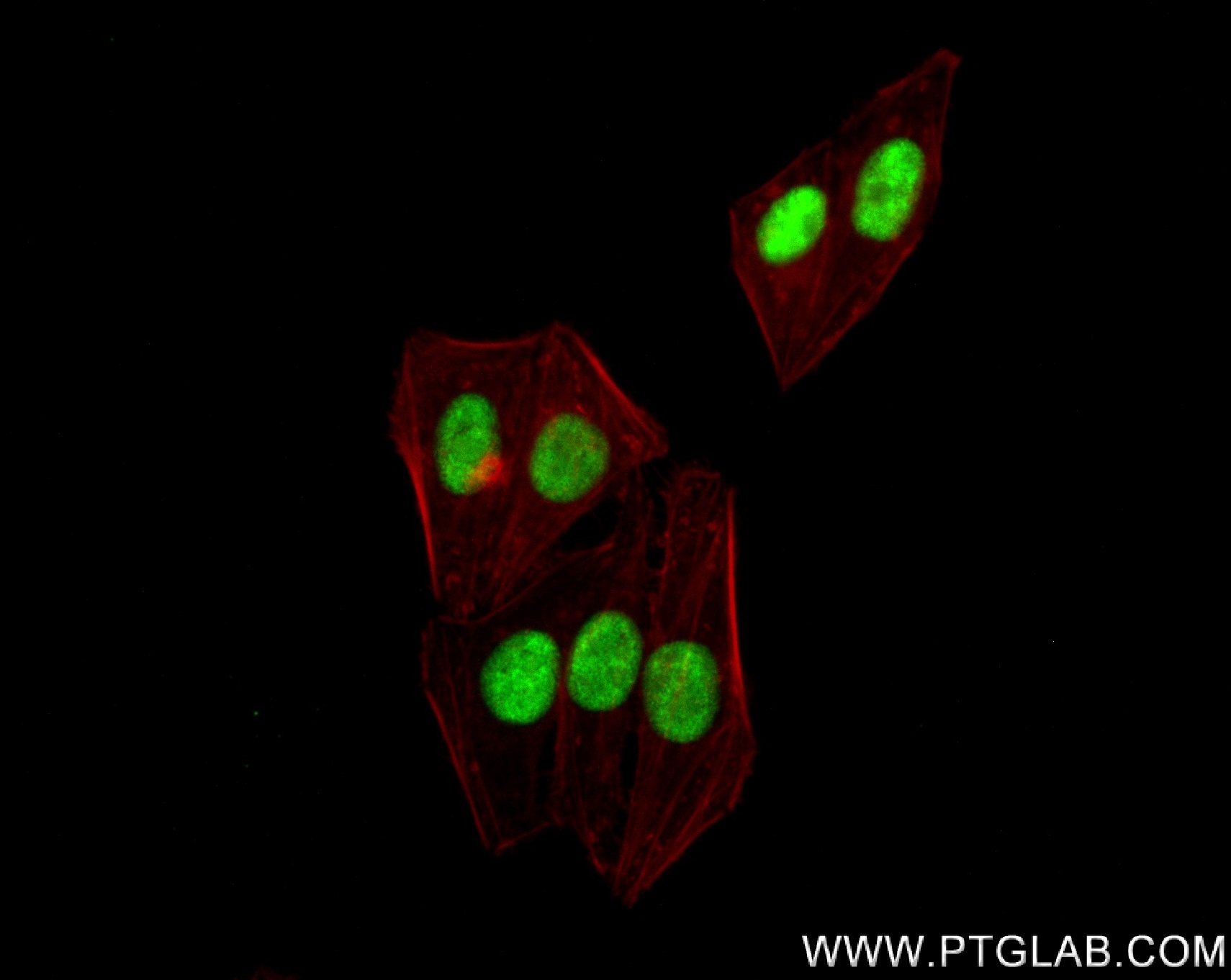 IF Staining of HepG2 using 83585-1-RR