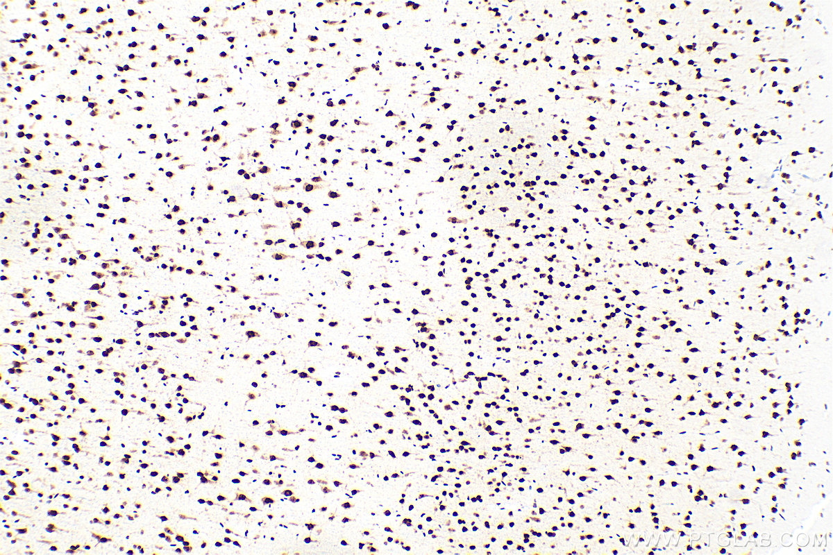 IHC staining of rat brain using 83585-1-RR