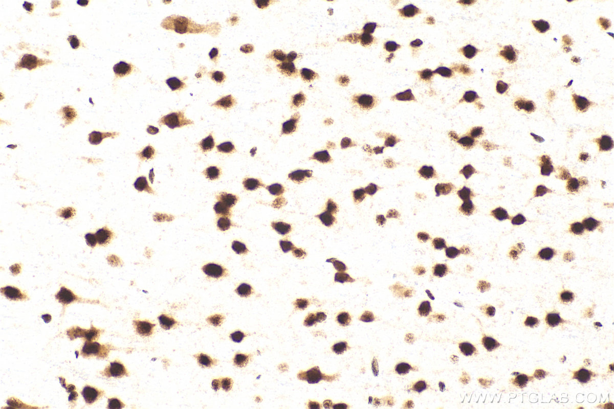 IHC staining of rat brain using 83585-1-RR