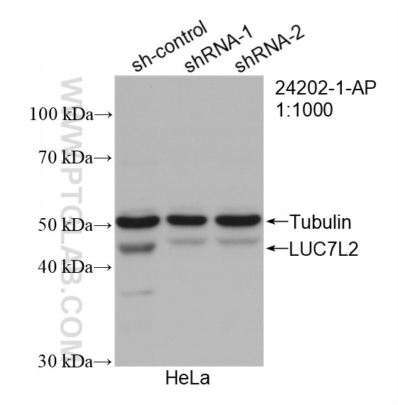 WB analysis of HeLa using 24202-1-AP