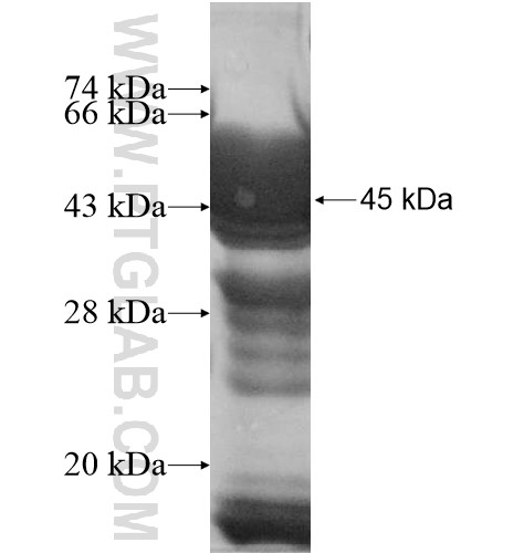 LUZP1 fusion protein Ag11641 SDS-PAGE LUZP1 fusion protein Ag11641 SDS-PAGE