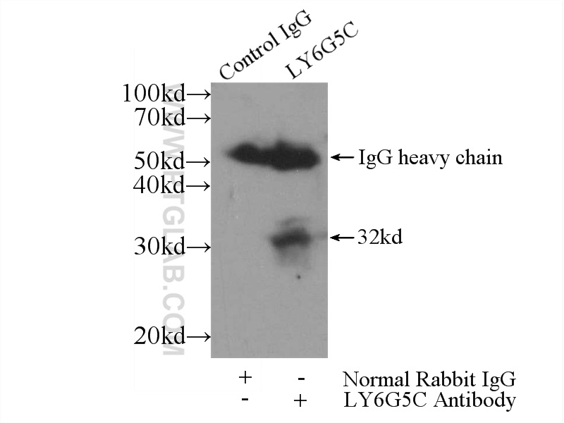 IP experiment of K-562 using 24633-1-AP