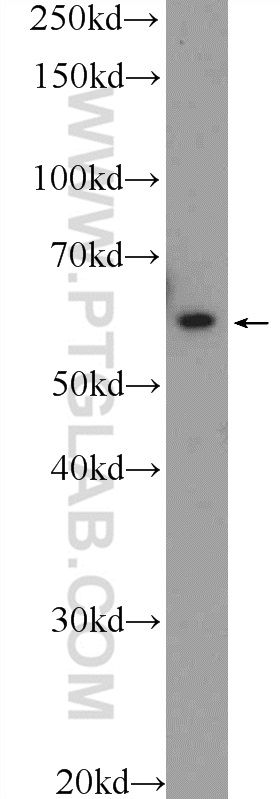 WB analysis of HL-60 using 25872-1-AP