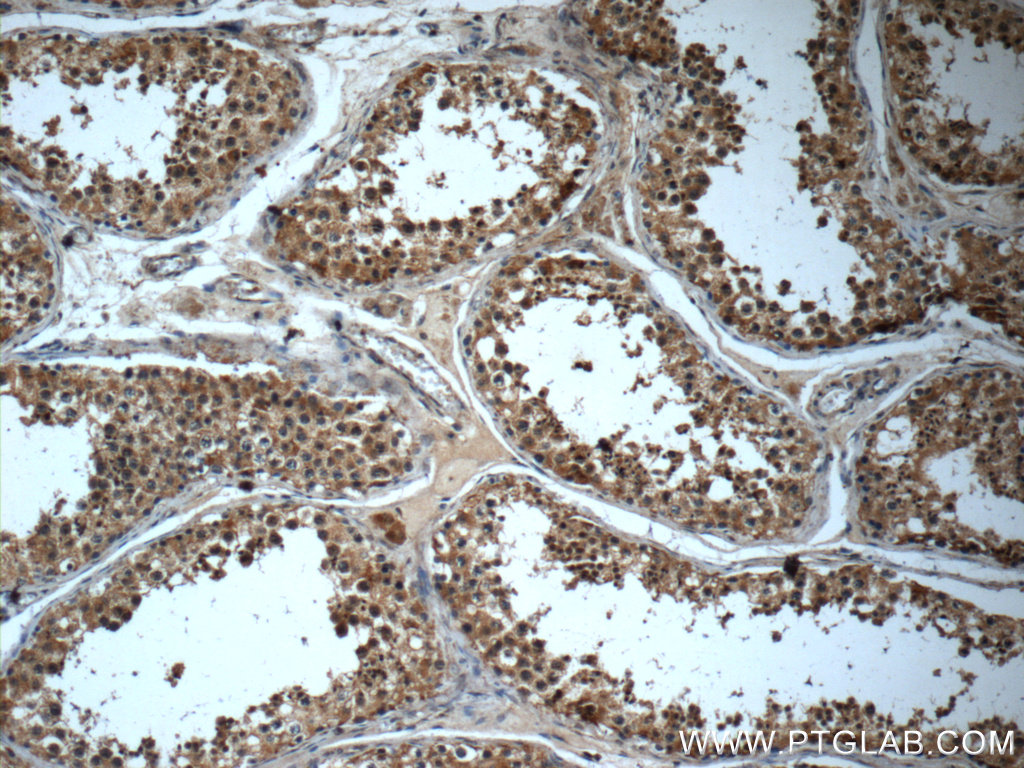 IHC staining of human testis using 23933-1-AP