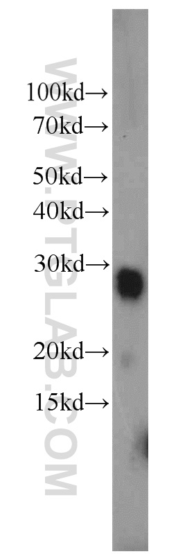 WB analysis of human testis using 12026-1-AP