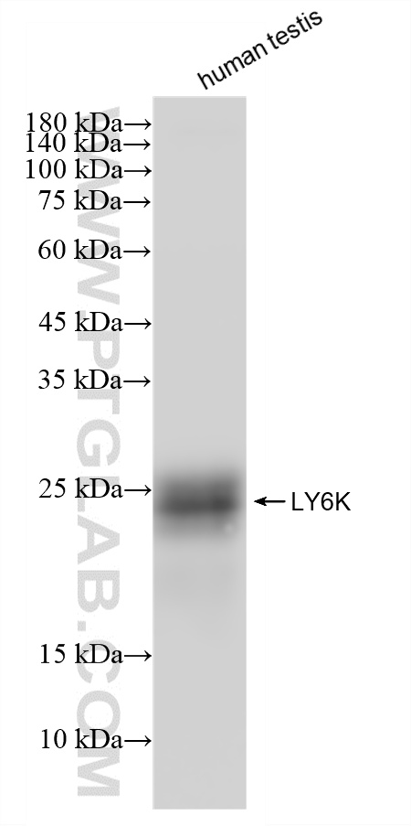 WB analysis using 87480-1-RR (same clone as 87480-1-PBS)