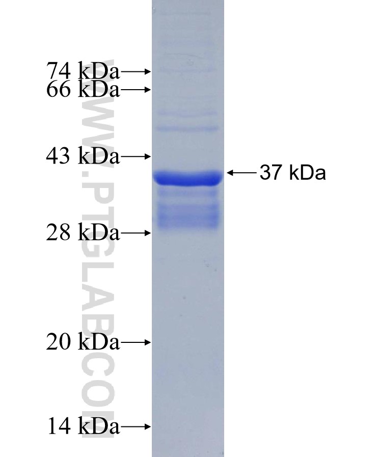 LY75 fusion protein Ag30155 SDS-PAGE LY75 fusion protein Ag30155 SDS-PAGE