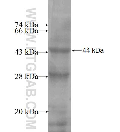 LY86 fusion protein Ag4494 SDS-PAGE LY86 fusion protein Ag4494 SDS-PAGE