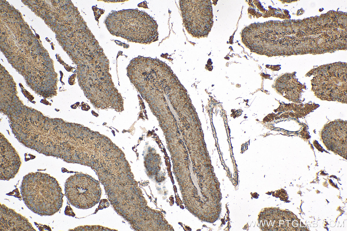 IHC staining of mouse testis using 11784-1-AP