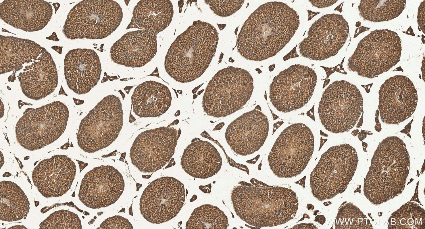 IHC staining of mouse testis using 24433-1-AP IHC staining of mouse testis using 24433-1-AP