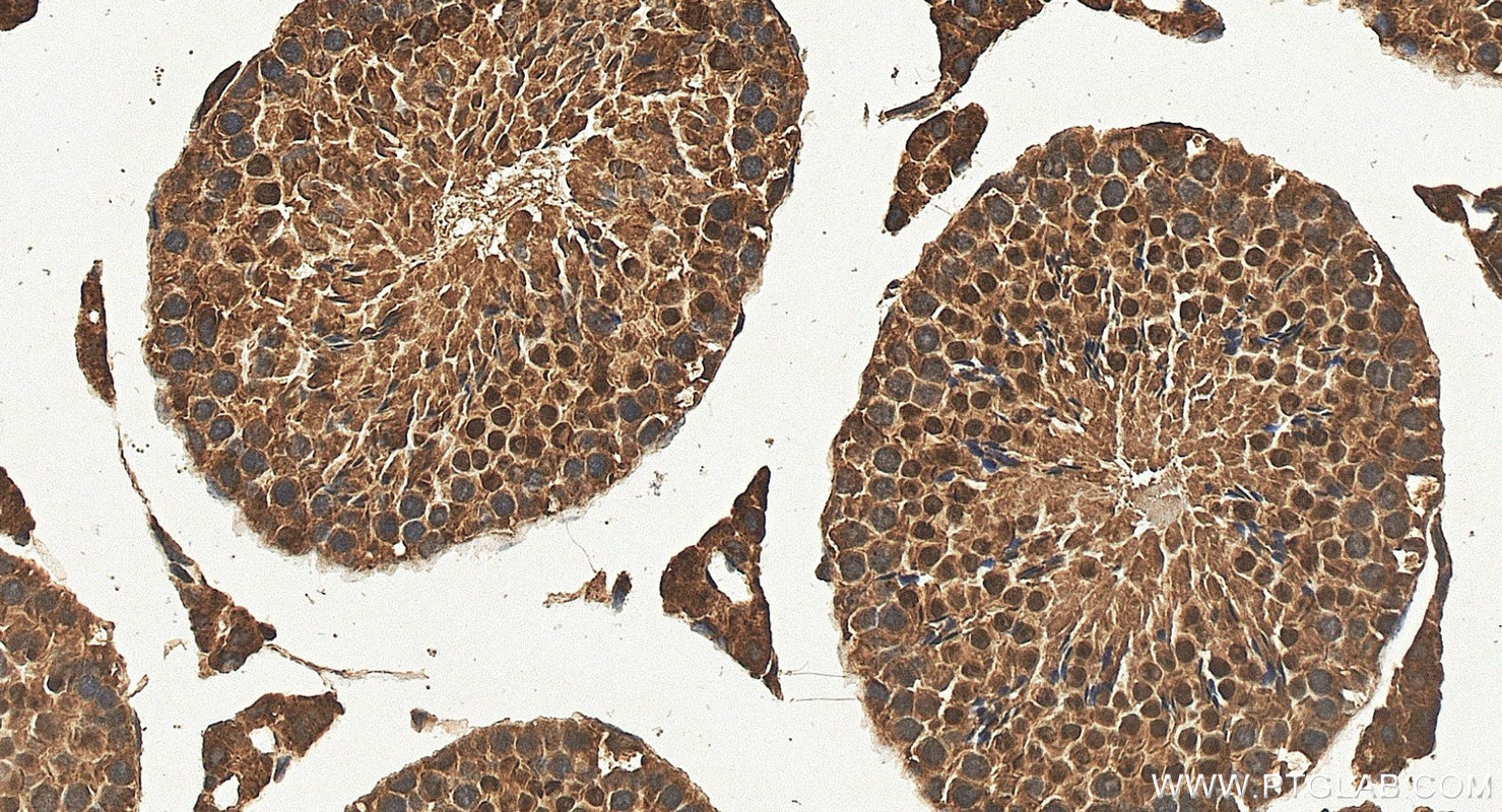 IHC staining of mouse testis using 24433-1-AP IHC staining of mouse testis using 24433-1-AP