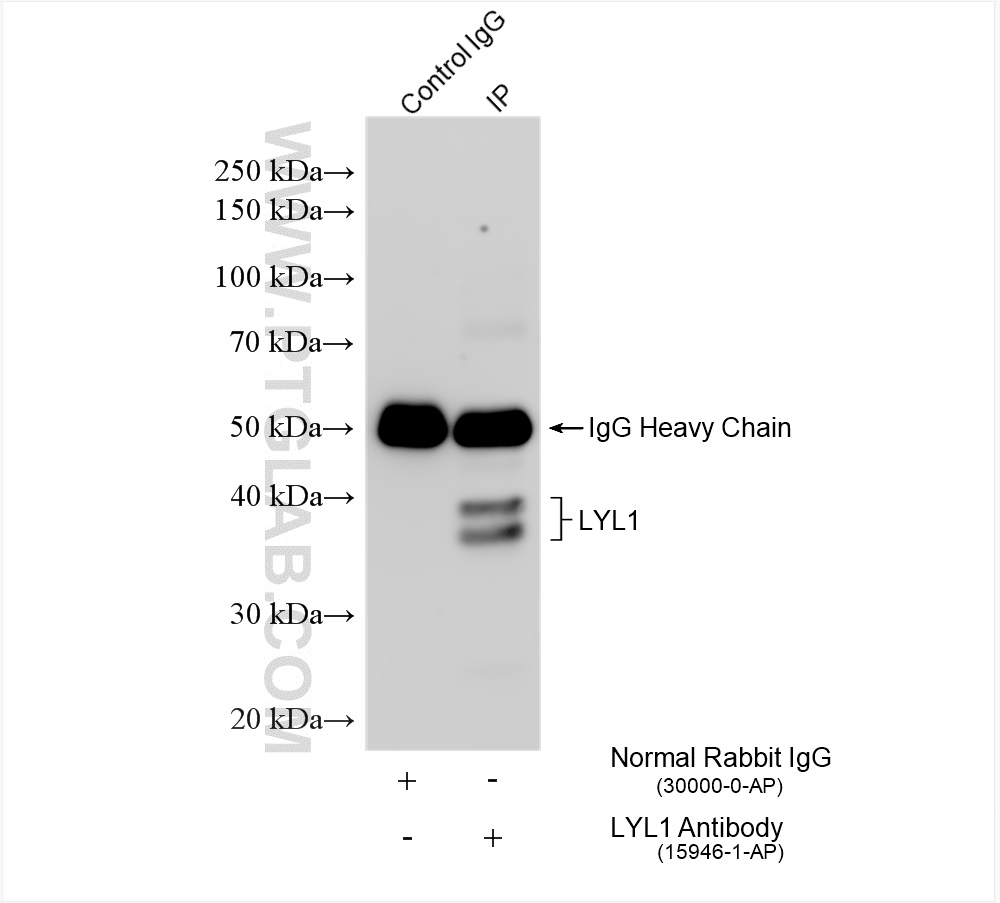 IP experiment of K-562 using 15946-1-AP