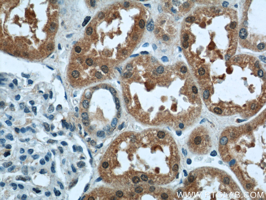 IHC staining of human kidney using 18135-1-AP