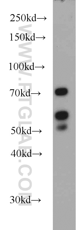 LYN Polyclonal antibody