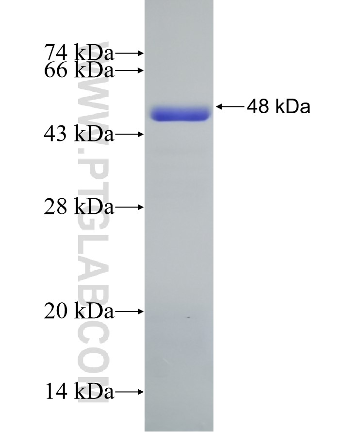 LYN fusion protein Ag12723 SDS-PAGE