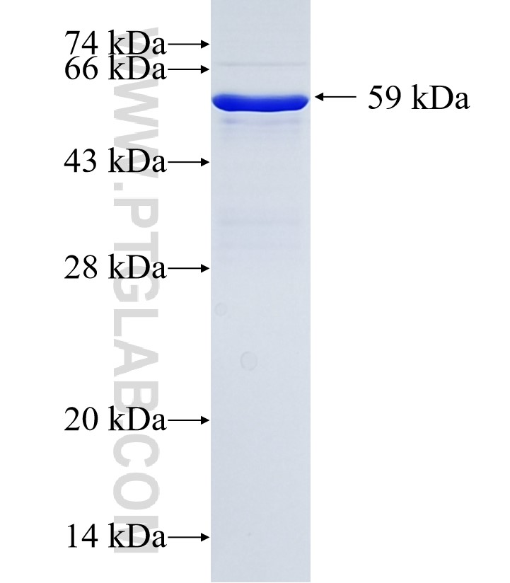 LYPD3 fusion protein Ag34961 SDS-PAGE