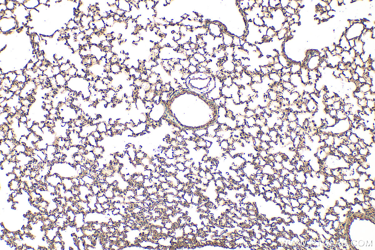 IHC staining of mouse lung using 25508-1-AP (same clone as 25508-1-PBS) IHC staining of mouse lung using 25508-1-AP (same clone as 25508-1-PBS)