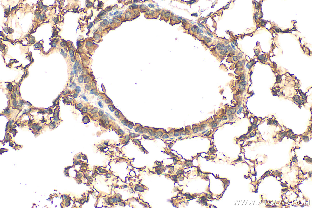 IHC staining of mouse lung using 25508-1-AP (same clone as 25508-1-PBS) IHC staining of mouse lung using 25508-1-AP (same clone as 25508-1-PBS)