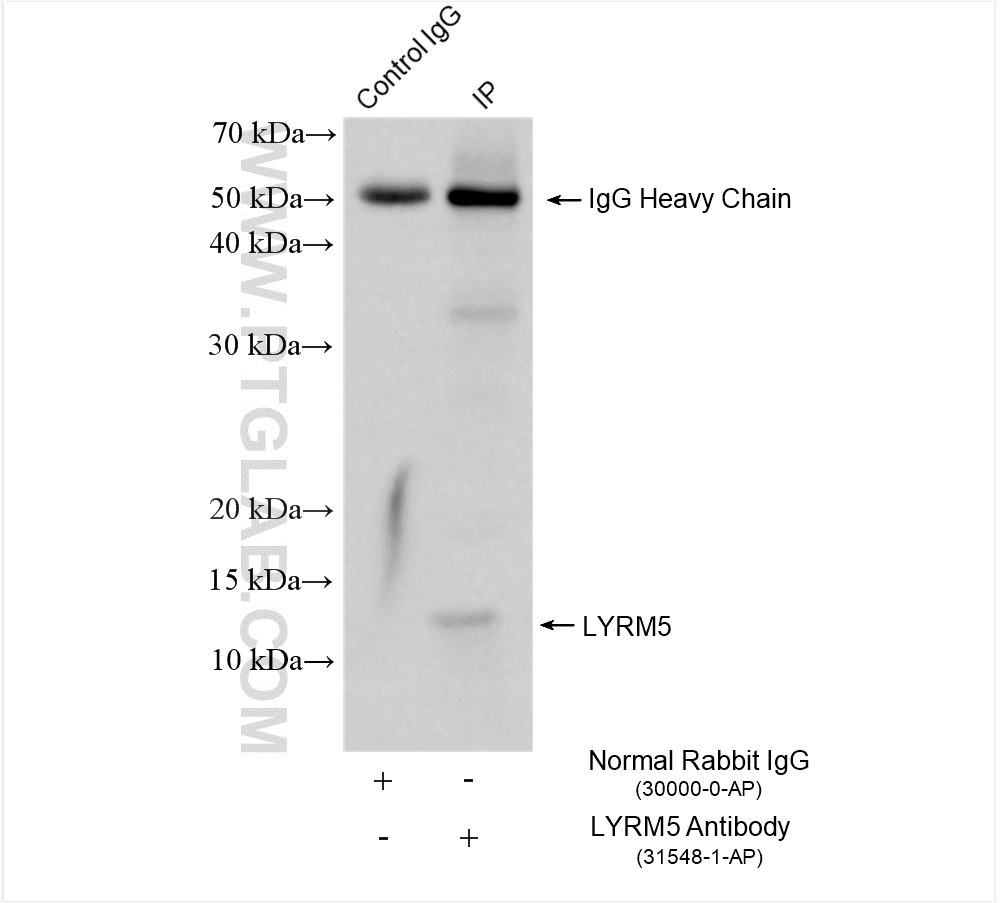 IP result of anti-LYRM5 (IP:31548-1-AP, 4ug; Detection:31548-1-AP 1:500) with mouse heart tissue lysate 1840 ug. IP experiment of mouse heart using 31548-1-AP