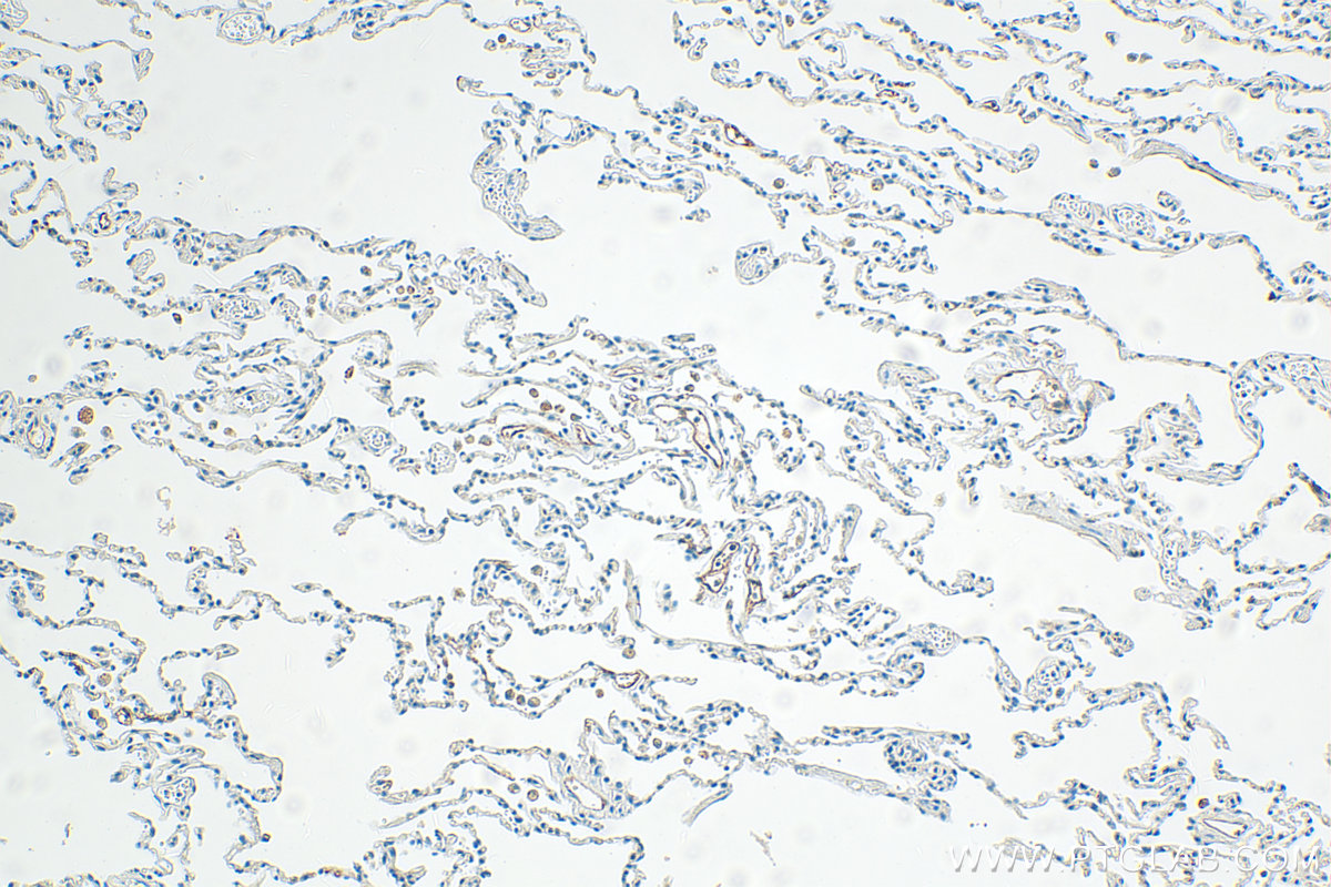 IHC staining of human lung using 32649-1-AP