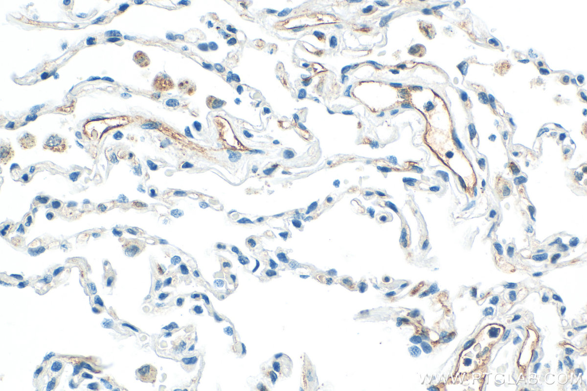 IHC staining of human lung using 32649-1-AP