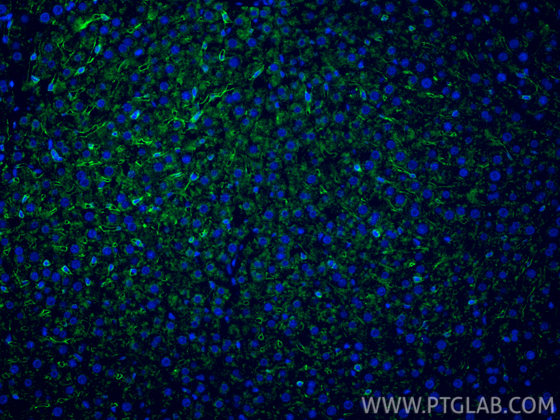 Immunofluorescent analysis of (4% PFA) fixed paraffin-embedded rat liver tissue using LYVE1 antibody (28321-1-AP) at dilution of 1:200 and CoraLite®488-Conjugated Goat Anti-Rabbit IgG(H+L) (<a class='green' href='/productredirect?CatalogNo=SA00013-2' target='_blank'>SA00013-2</a>). Heat mediated antigen retrieval with Tris-EDTA buffer (pH 9.0). IF Staining of rat liver using 28321-1-AP