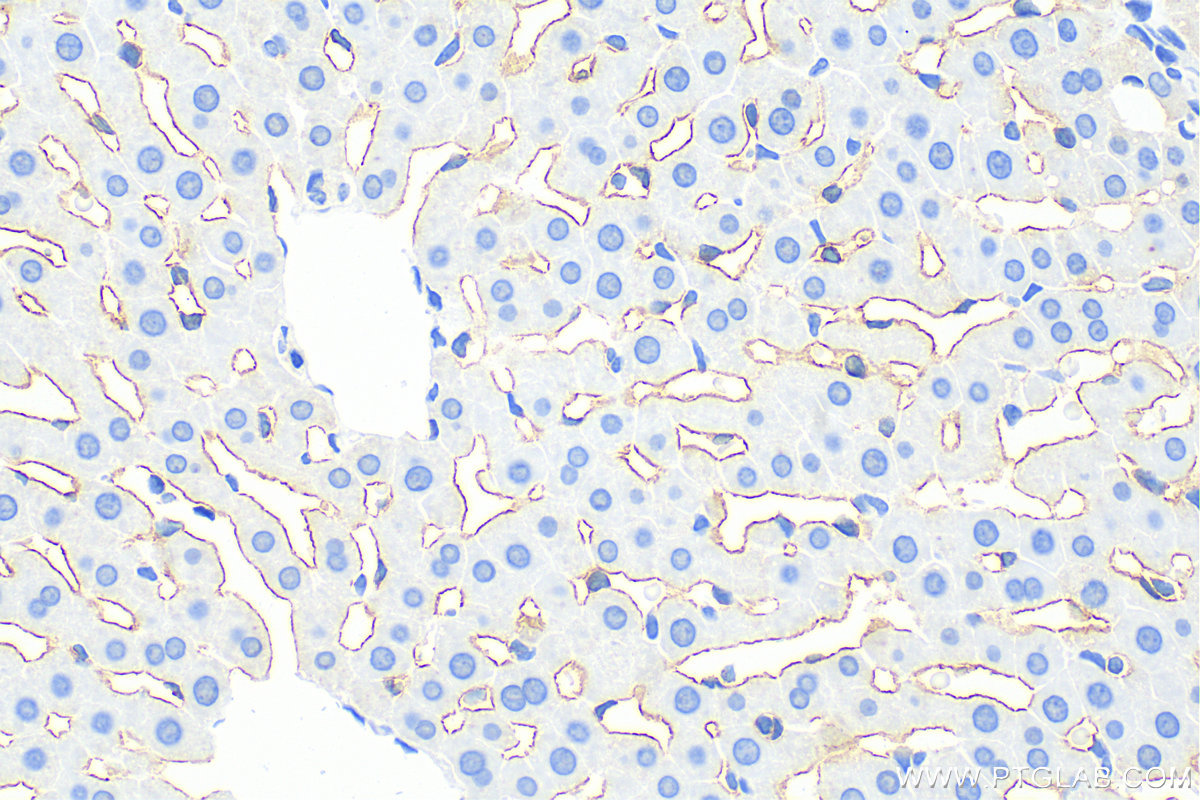 IHC staining of rat liver using 28321-1-AP (same clone as 28321-1-PBS)