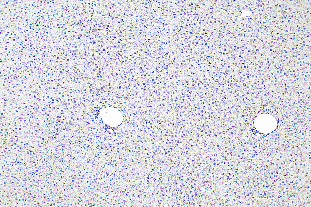 Immunohistochemical analysis of paraffin-embedded rat liver tissue slide using 28321-1-AP (LYVE1 antibody) at dilution of 1:800 (under 10x lens). Heat mediated antigen retrieval with Tris-EDTA buffer (pH 9.0). IHC staining of rat liver using 28321-1-AP