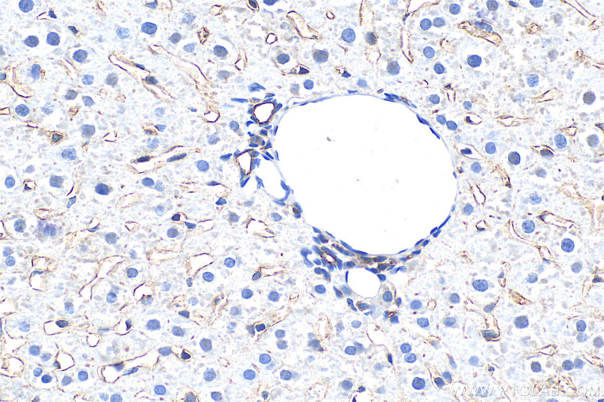 Immunohistochemical analysis of paraffin-embedded rat liver tissue slide using 28321-1-AP (LYVE1 antibody) at dilution of 1:800 (under 40x lens). Heat mediated antigen retrieval with Tris-EDTA buffer (pH 9.0). IHC staining of rat liver using 28321-1-AP