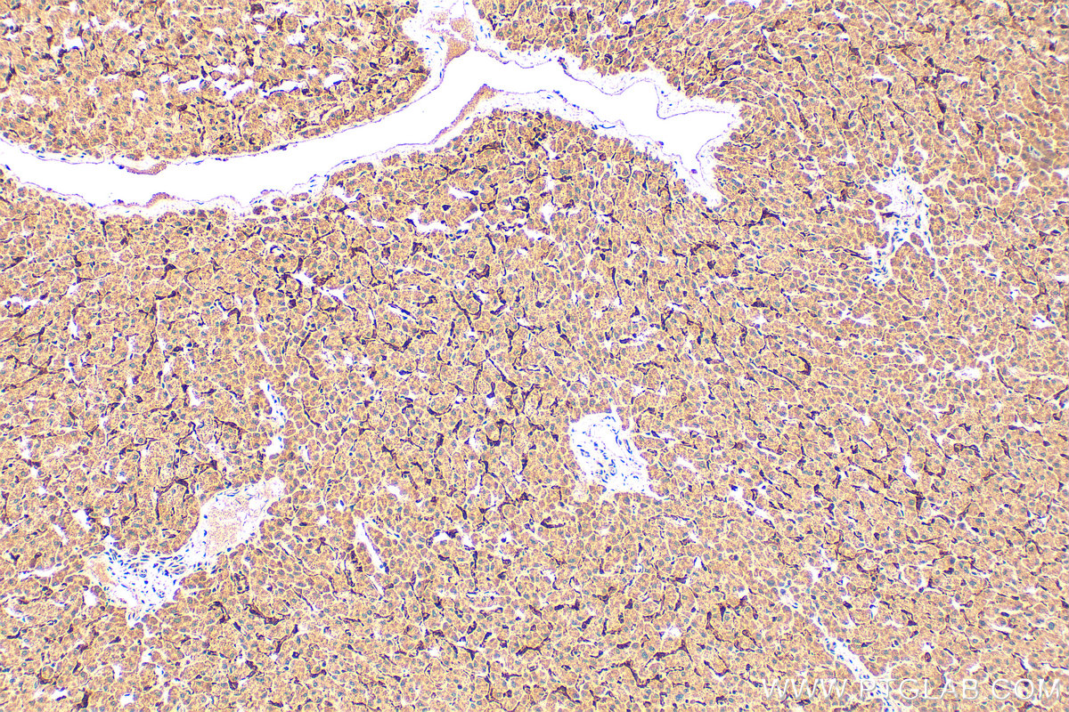 IHC staining of human liver using 28321-1-AP