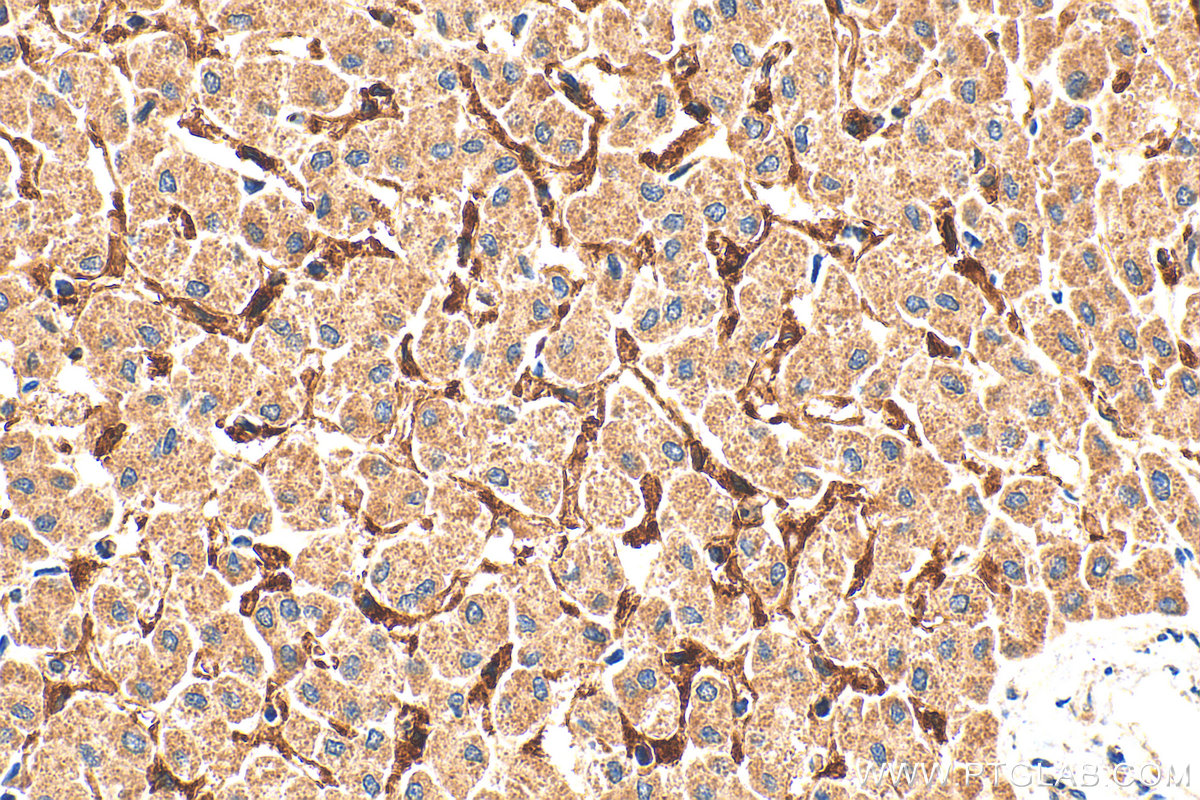 IHC staining of human liver using 28321-1-AP